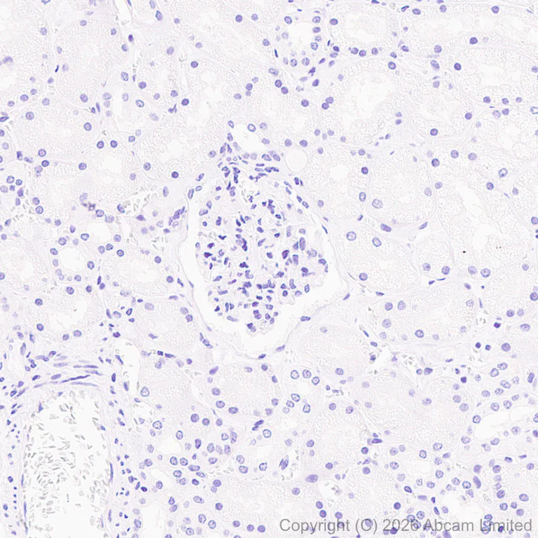 Immunohistochemistry (Formalin/PFA-fixed paraffin-embedded sections) - Anti-HERV-FRD antibody [EPR30312-632] (AB326102)