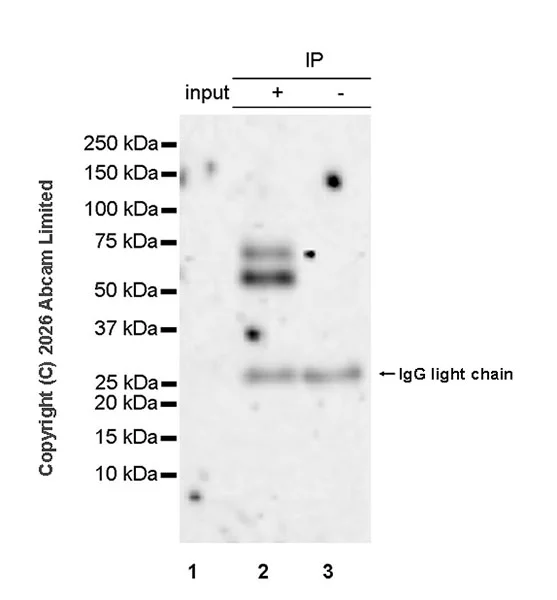 Immunoprecipitation - Anti-HERV-FRD antibody [EPR30312-632] (AB326102)