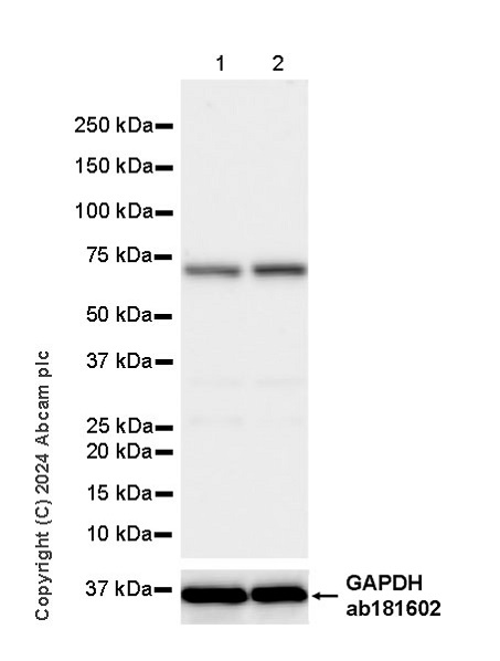Western blot - Anti-HERV-K-env antibody [EPR27172-7] (AB319031)