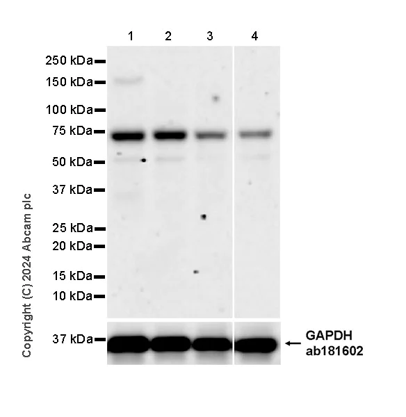 Western blot - Anti-HERV-K-env antibody [EPR27172-7] - BSA and Azide free (AB319032)