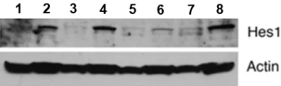 Western blot - Anti-Hes1 antibody (AB71559)