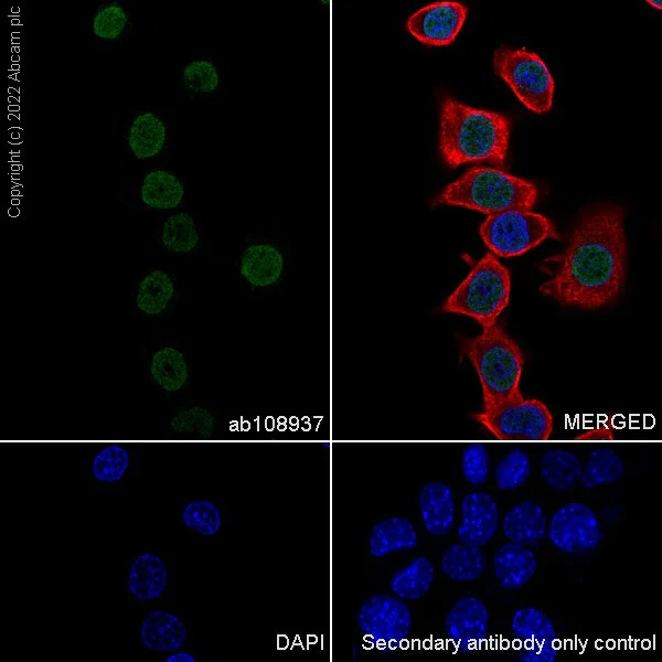 Immunocytochemistry/ Immunofluorescence - Anti-Hes1 antibody [EPR4226] (AB108937)