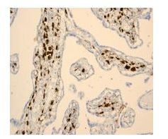 Immunohistochemistry (Formalin/PFA-fixed paraffin-embedded sections) - Anti-Hes1 antibody [EPR4226] (AB108937), expandable thumbnail