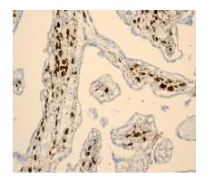 Immunohistochemistry (Formalin/PFA-fixed paraffin-embedded sections) - Anti-Hes1 antibody [EPR4226] (AB108937)