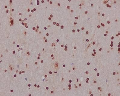 Immunohistochemistry (Formalin/PFA-fixed paraffin-embedded sections) - Anti-Hes1 antibody [EPR4226] (AB108937), expandable thumbnail