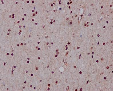 Immunohistochemistry (Formalin/PFA-fixed paraffin-embedded sections) - Anti-Hes1 antibody [EPR4226] (ab108937), expandable thumbnail