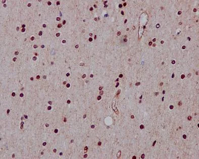 Immunohistochemistry (Formalin/PFA-fixed paraffin-embedded sections) - Anti-Hes1 antibody [EPR4226] (AB108937)