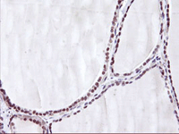 Immunohistochemistry (Formalin/PFA-fixed paraffin-embedded sections) - Anti-Hes1 antibody [OTI2D2] (AB119776)