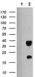 Western blot - Anti-Hes1 antibody [OTI2D2] (AB119776)