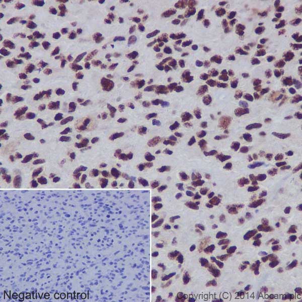 Immunohistochemistry (Formalin/PFA-fixed paraffin-embedded sections) - Anti-HES5 antibody [EPR15578] (AB194111)