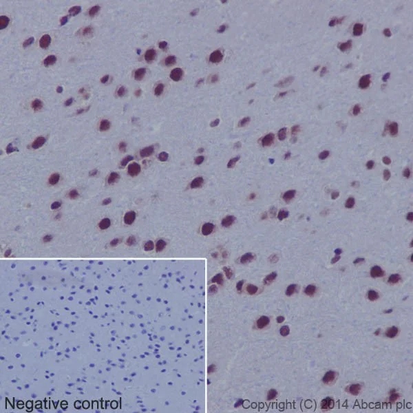 Immunohistochemistry (Formalin/PFA-fixed paraffin-embedded sections) - Anti-HES5 antibody [EPR15578] (AB194111)