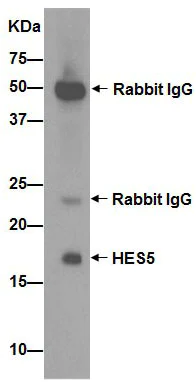 Immunoprecipitation - Anti-HES5 antibody [EPR15578] - BSA and Azide free (AB236142)