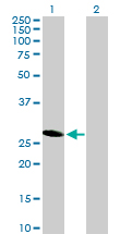 Western blot - Anti-HES6 antibody (AB172800)
