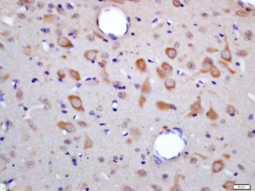 Immunohistochemistry (Formalin/PFA-fixed paraffin-embedded sections) - Anti-HES6 antibody (AB218037)