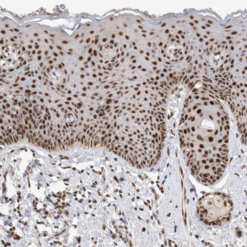 Immunohistochemistry (Formalin/PFA-fixed paraffin-embedded sections) - Anti-HESX1 antibody (AB246949), expandable thumbnail
