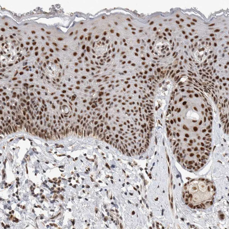Immunohistochemistry (Formalin/PFA-fixed paraffin-embedded sections) - Anti-HESX1 antibody (AB246949)