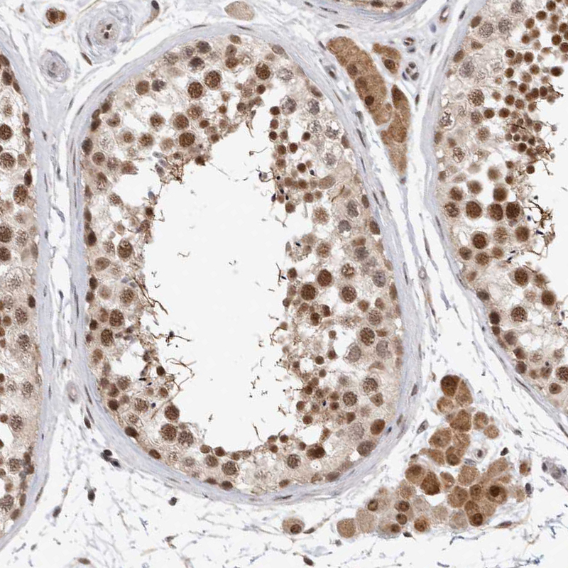 Immunohistochemistry (Formalin/PFA-fixed paraffin-embedded sections) - Anti-HESX1 antibody (AB246949), expandable thumbnail