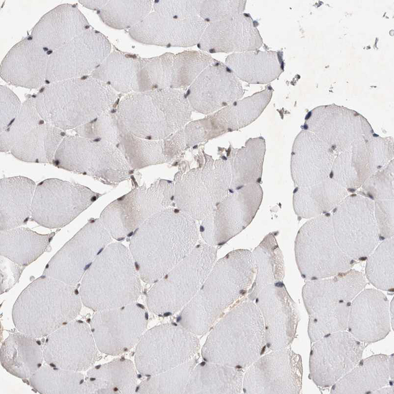 Immunohistochemistry (Formalin/PFA-fixed paraffin-embedded sections) - Anti-HESX1 antibody (AB246949), expandable thumbnail