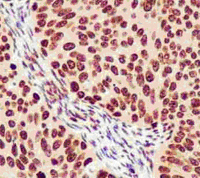 Immunohistochemistry (Formalin/PFA-fixed paraffin-embedded sections) - Anti-Heterogeneous Nuclear Ribonucleoprotein (A1-like) antibody [EPR13673] (AB180124)