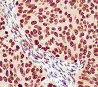 Immunohistochemistry (Formalin/PFA-fixed paraffin-embedded sections) - Anti-Heterogeneous Nuclear Ribonucleoprotein (A1-like) antibody [EPR13673] - BSA and Azide free (AB250137)