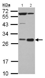 Western blot - Anti-Hex antibody (AB153899), expandable thumbnail