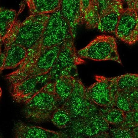 Immunocytochemistry/ Immunofluorescence - Anti-Hex antibody (AB220764)