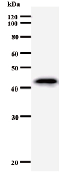 Western blot - Anti-Hex antibody [HHE5I261] (AB50836)