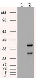 Western blot - Anti-Hex antibody [OTI3E6] (AB117864)
