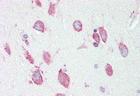 Immunohistochemistry (Formalin/PFA-fixed paraffin-embedded sections) - Anti-HEXA antibody (AB230488), expandable thumbnail