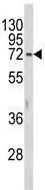 Western blot - Anti-HEXA antibody (AB230488)