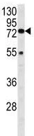 Western blot - Anti-HEXA antibody (AB230488)