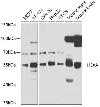 Western blot - Anti-HEXA antibody - C-terminal (AB189865)