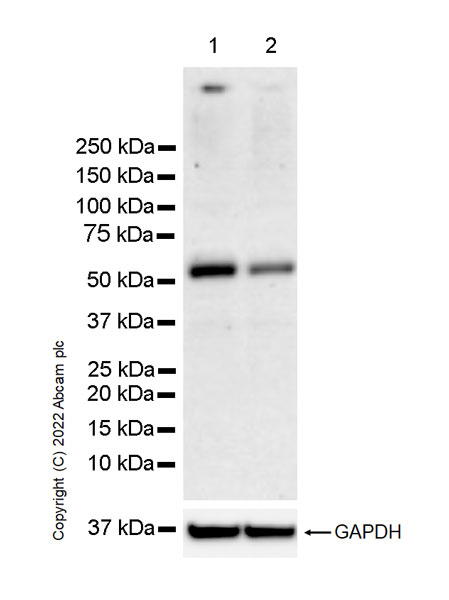Western blot - Anti-HEXA antibody [EPR26393-80] (AB303484), expandable thumbnail