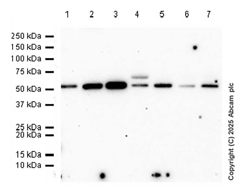 Western blot - Anti-HEXA antibody [EPR26393-80] (AB303484), expandable thumbnail