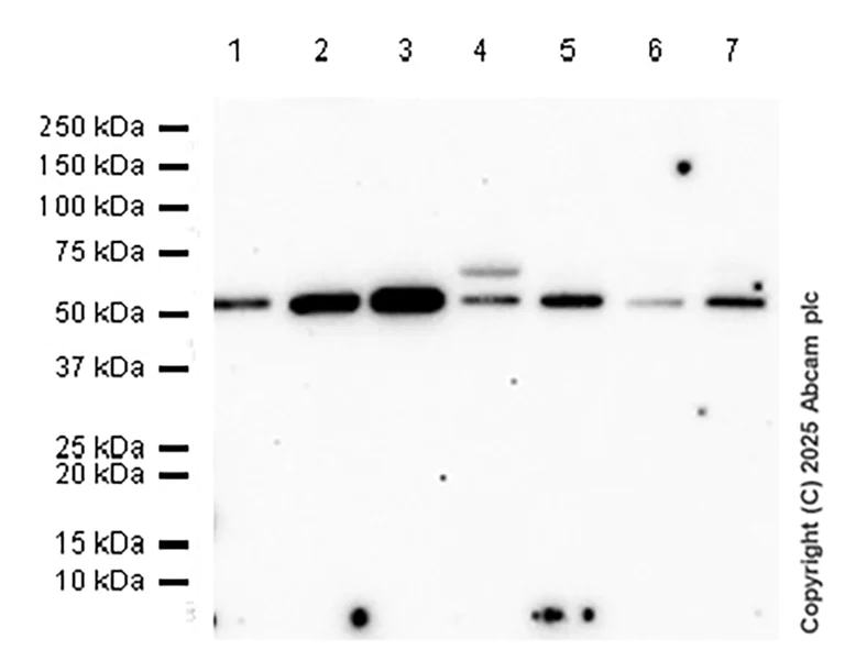 Western blot - Anti-HEXA antibody [EPR26393-80] (AB303484)