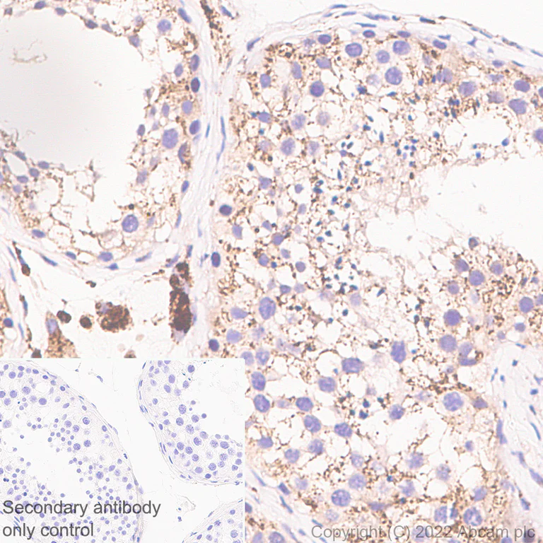 Immunohistochemistry (Formalin/PFA-fixed paraffin-embedded sections) - Anti-HEXA antibody [EPR26393-80] - BSA and Azide free (AB303485)