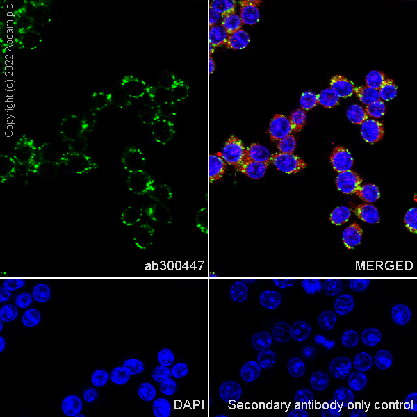 Immunocytochemistry/ Immunofluorescence - Anti-HEXA antibody [EPR26394-74] (AB300447), expandable thumbnail