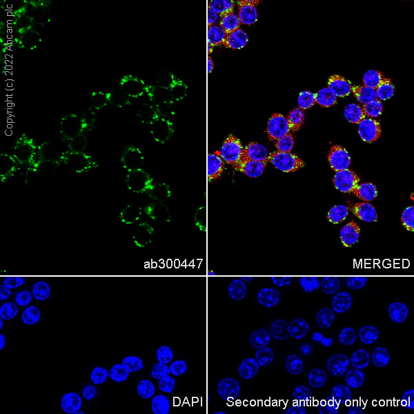 Immunocytochemistry/ Immunofluorescence - Anti-HEXA antibody [EPR26394-74] (AB300447)