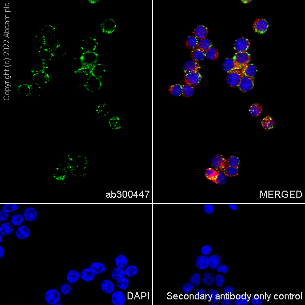 Immunocytochemistry/ Immunofluorescence - Anti-HEXA antibody [EPR26394-74] (AB300447), expandable thumbnail