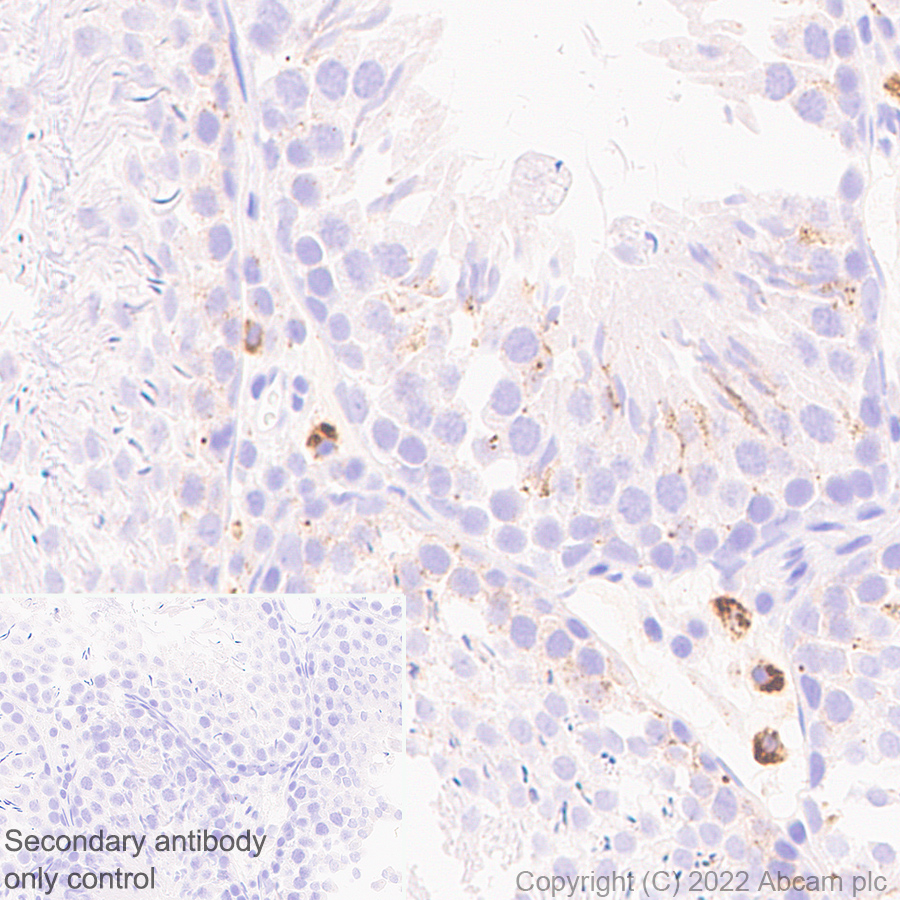 Immunohistochemistry (Formalin/PFA-fixed paraffin-embedded sections) - Anti-HEXA antibody [EPR26394-74] (ab300447), expandable thumbnail