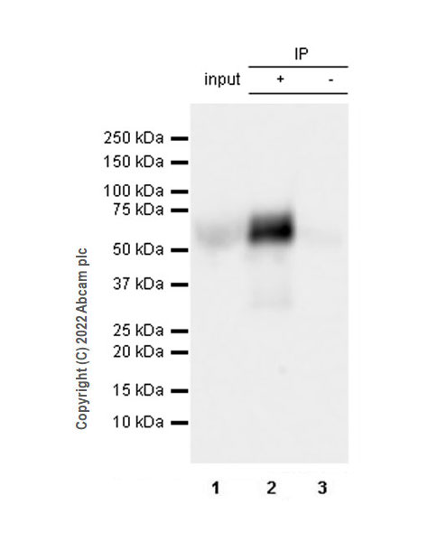 Immunoprecipitation - Anti-HEXA antibody [EPR26394-74] (AB300447), expandable thumbnail