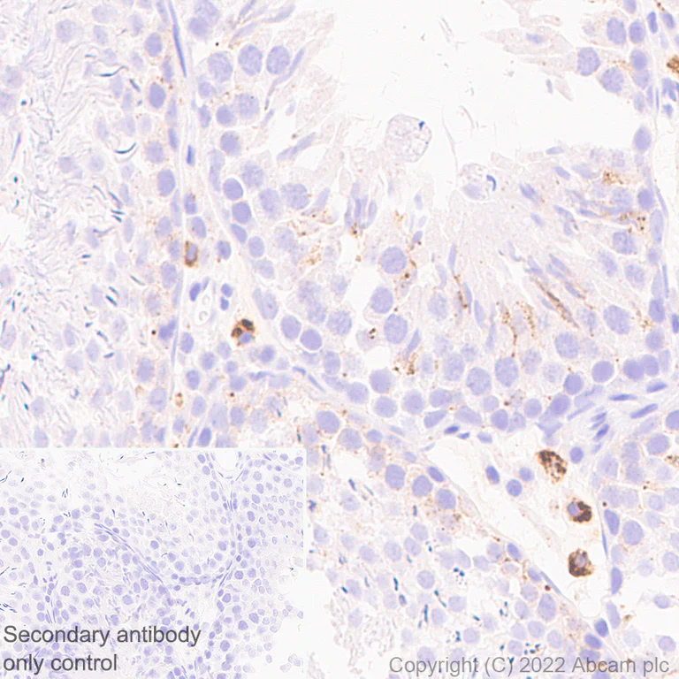 Immunohistochemistry (Formalin/PFA-fixed paraffin-embedded sections) - Anti-HEXA antibody [EPR26394-74] (BSA and Azide free) (AB300448)