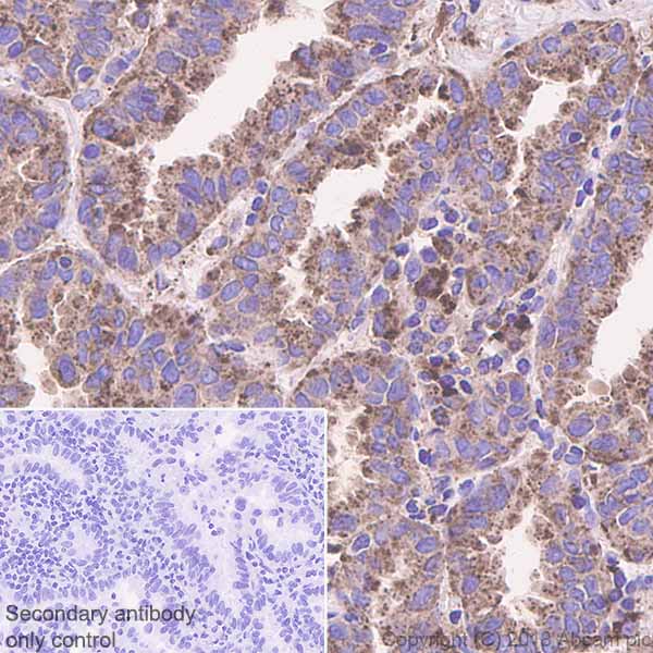 Immunohistochemistry (Formalin/PFA-fixed paraffin-embedded sections) - Anti-HEXB antibody [EPR7978] (AB140649)