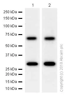 Western blot - Anti-HEXB antibody [EPR7978] (AB140649)