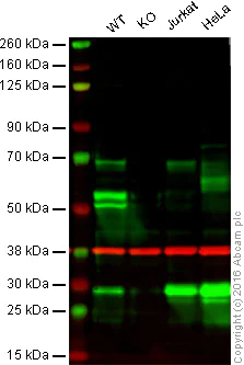Western blot - Anti-HEXB antibody [EPR7978] - BSA and Azide free (AB248929)