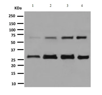 Western blot - Anti-HEXB antibody [EPR7978] - BSA and Azide free (AB248929)