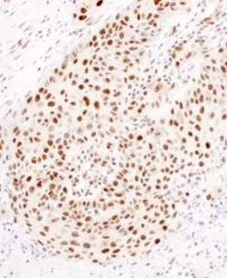 Immunohistochemistry (Formalin/PFA-fixed paraffin-embedded sections) - Anti-HEXIM1 antibody (AB245495)