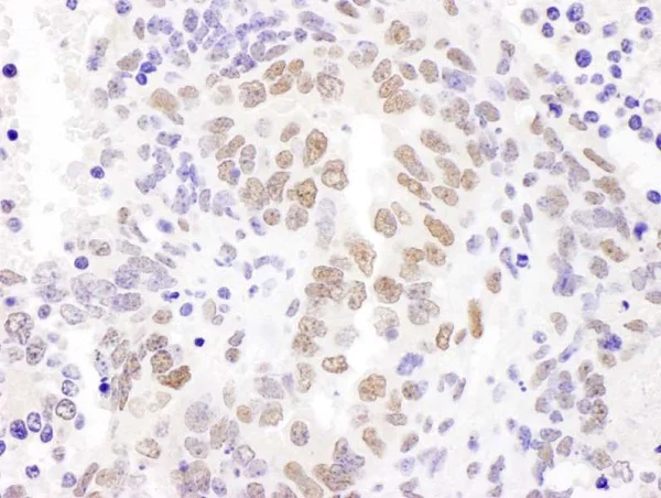 Immunohistochemistry (Formalin/PFA-fixed paraffin-embedded sections) - Anti-HEXIM1 antibody (AB245495)