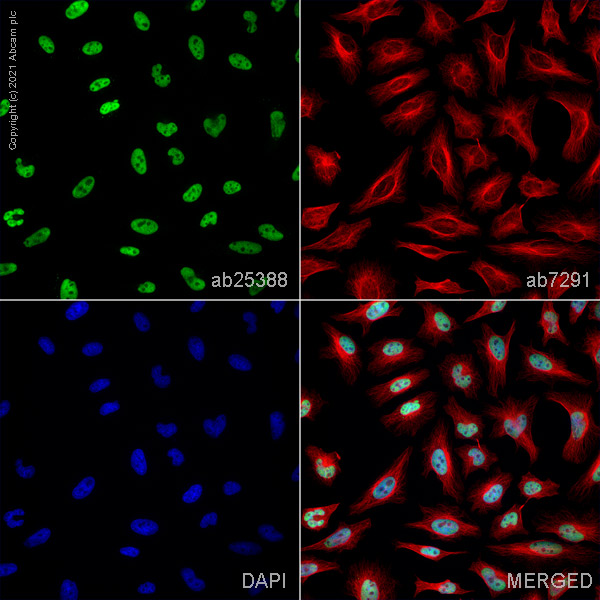 Immunocytochemistry/ Immunofluorescence - Anti-HEXIM1 antibody (AB25388), expandable thumbnail