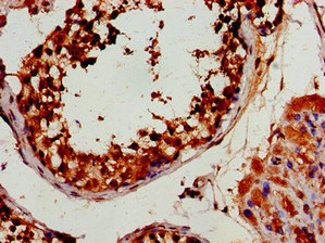 Immunohistochemistry (Formalin/PFA-fixed paraffin-embedded sections) - Anti-HEXIM2 antibody (AB234979)